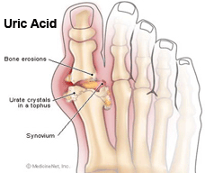 Uric Acid